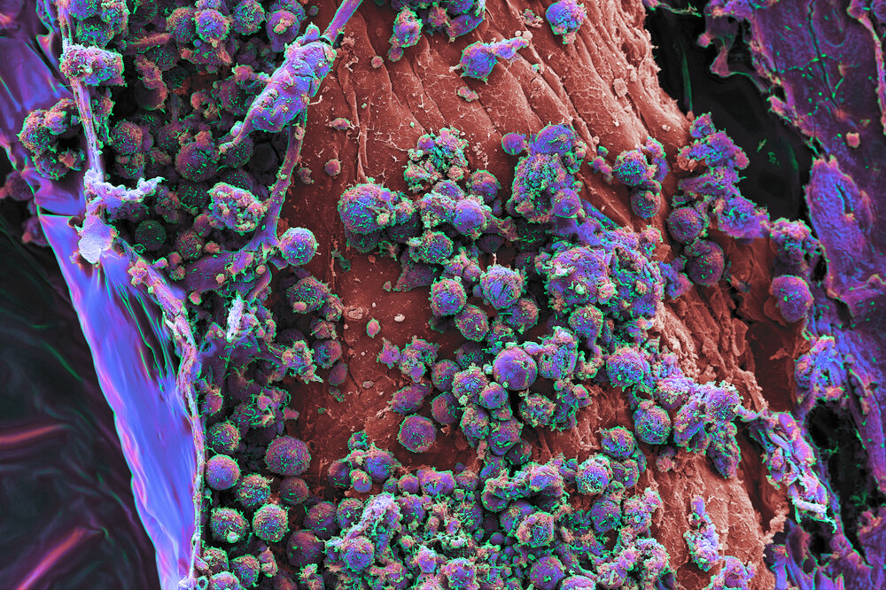 image of lab-grown human tissue